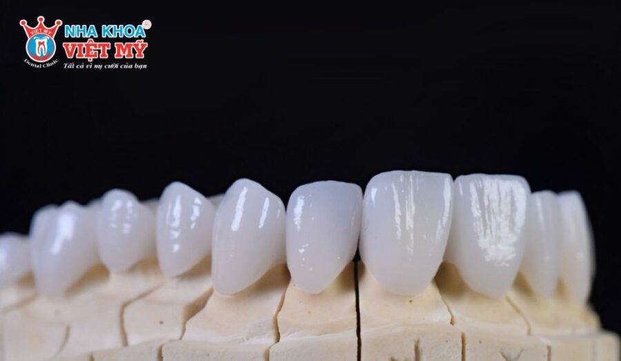 Răng sứ toàn sứ là dòng răng sứ được đánh giá cao trên thị trường hiện nay