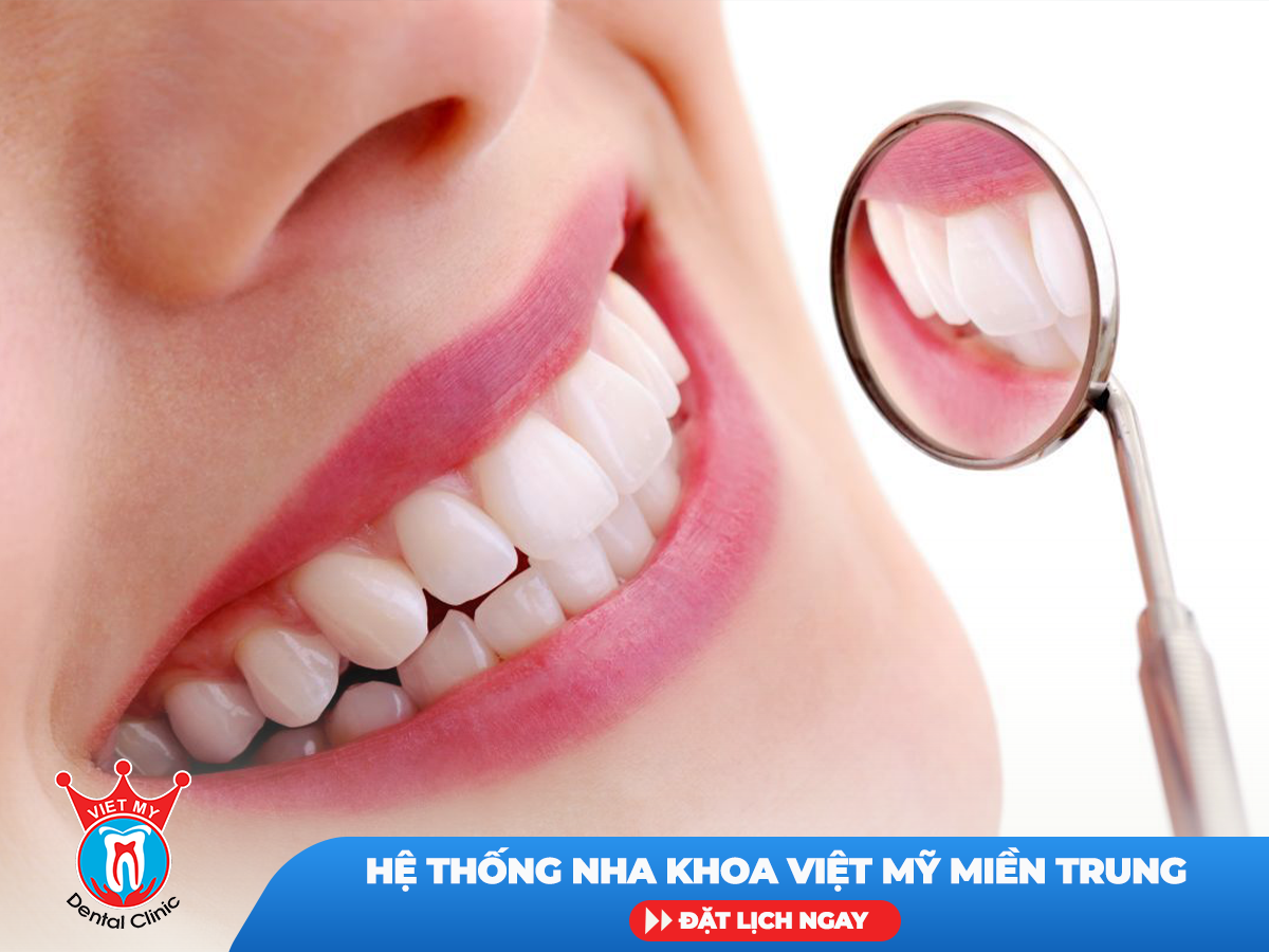 răng sứ thẩm mỹ