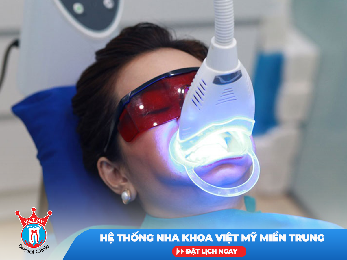 Tẩy trắng răng bằng đèn Plasma