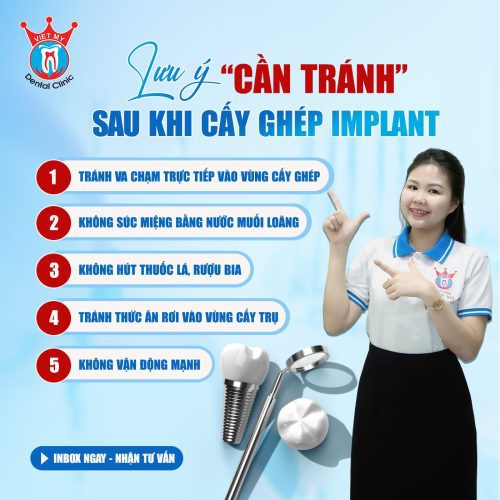 trồng răng implant