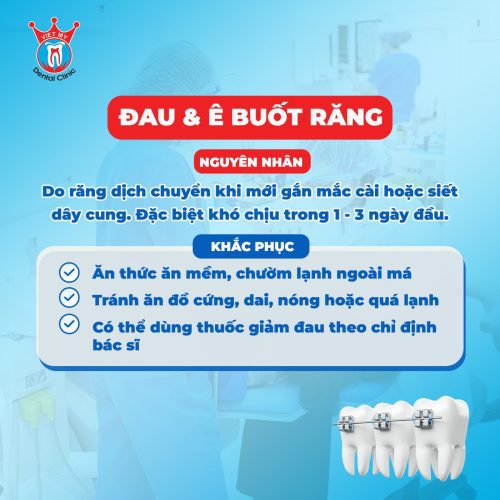 lưu ý khi niềng răng