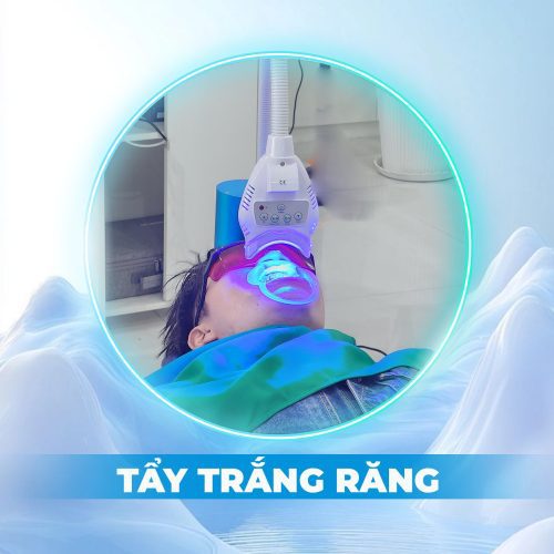 tẩy trắng răng