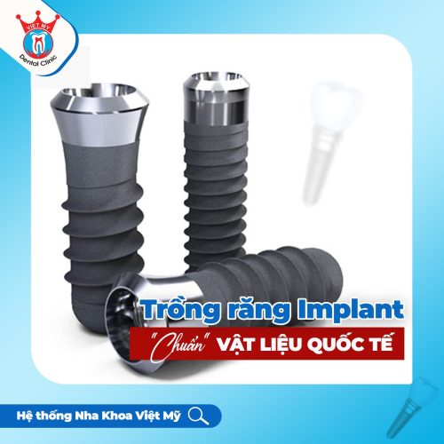 trồng răng implant